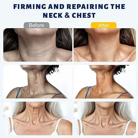 Roller Massage Neck Cream 🧴 Collagen & Hyaluronic Acid | Firms Neck, Reduces Wrinkles & Double Chin✨