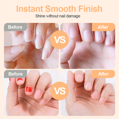 💅2-in-1 Electric Nail Trimmer & Buffer – Smart Safe Nail Clipping & Polishing